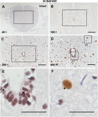 BAF45D Downregulation in Spinal Cord Ependymal Cells Following Spinal Cord Injury in Adult Rats and Its Potential Role in the Development of Neuronal Lesions